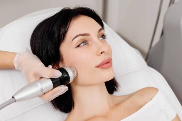 Fractional RF Resurfacing: What It Can (and Can't) Do